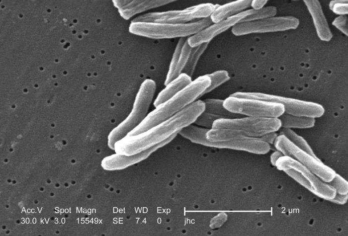 34ba30e0f8 34452 43914 mycobacterium tuberculosis meb 15549x janice haney carr cdc dp 06
